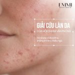 Chăm sóc làn da của chị em văn phòng tại Emmi Beauty Skinlab