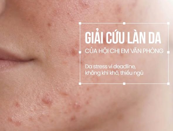 Chăm sóc da cho chị em văn phòng tại Emmi Beauty Skinlab
